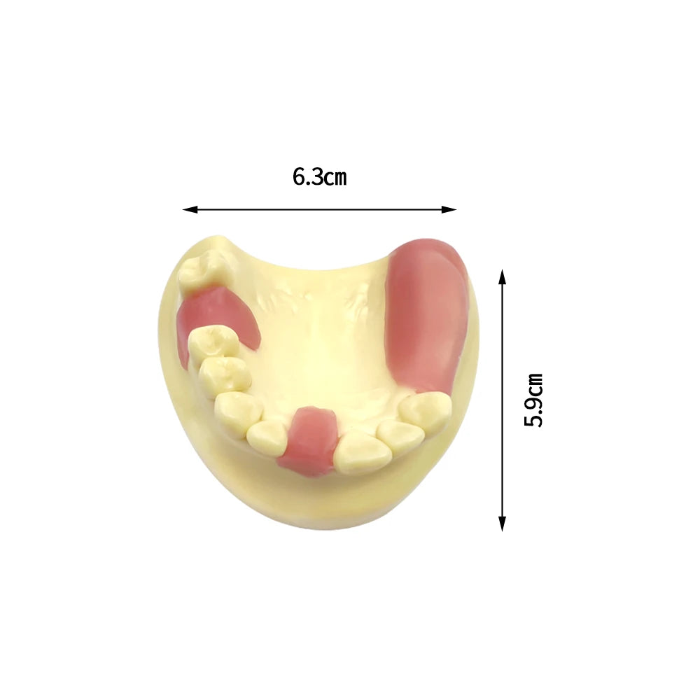 Maxillary Sinus & Implant Teaching Model (Soft Gum)