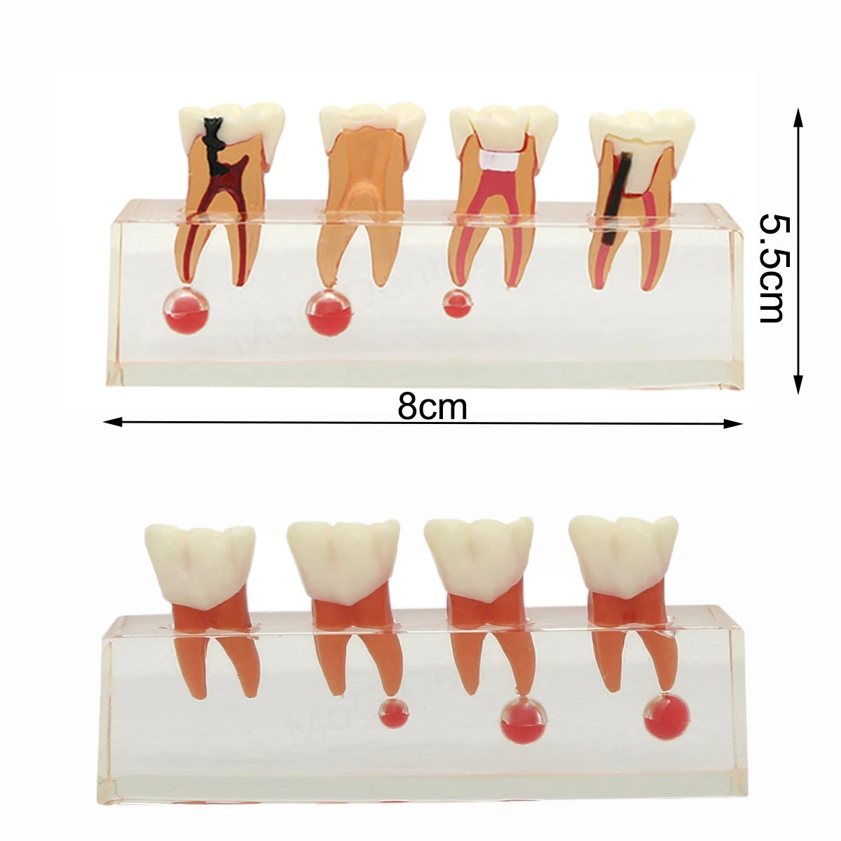 Root Canal Anatomy Teaching Model