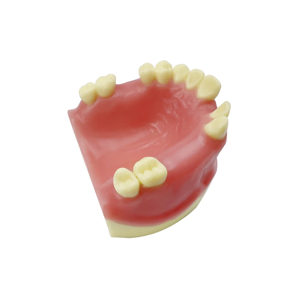 Maxillary Sinus & Implant Teaching Model (Soft Gum)