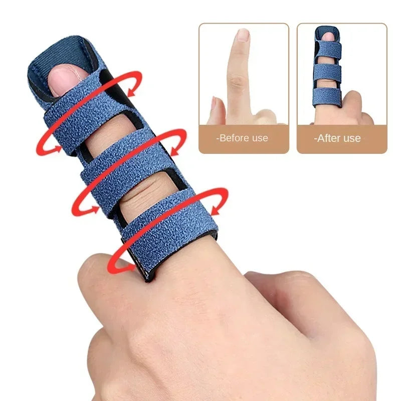 Adjustable Finger Correction Splint