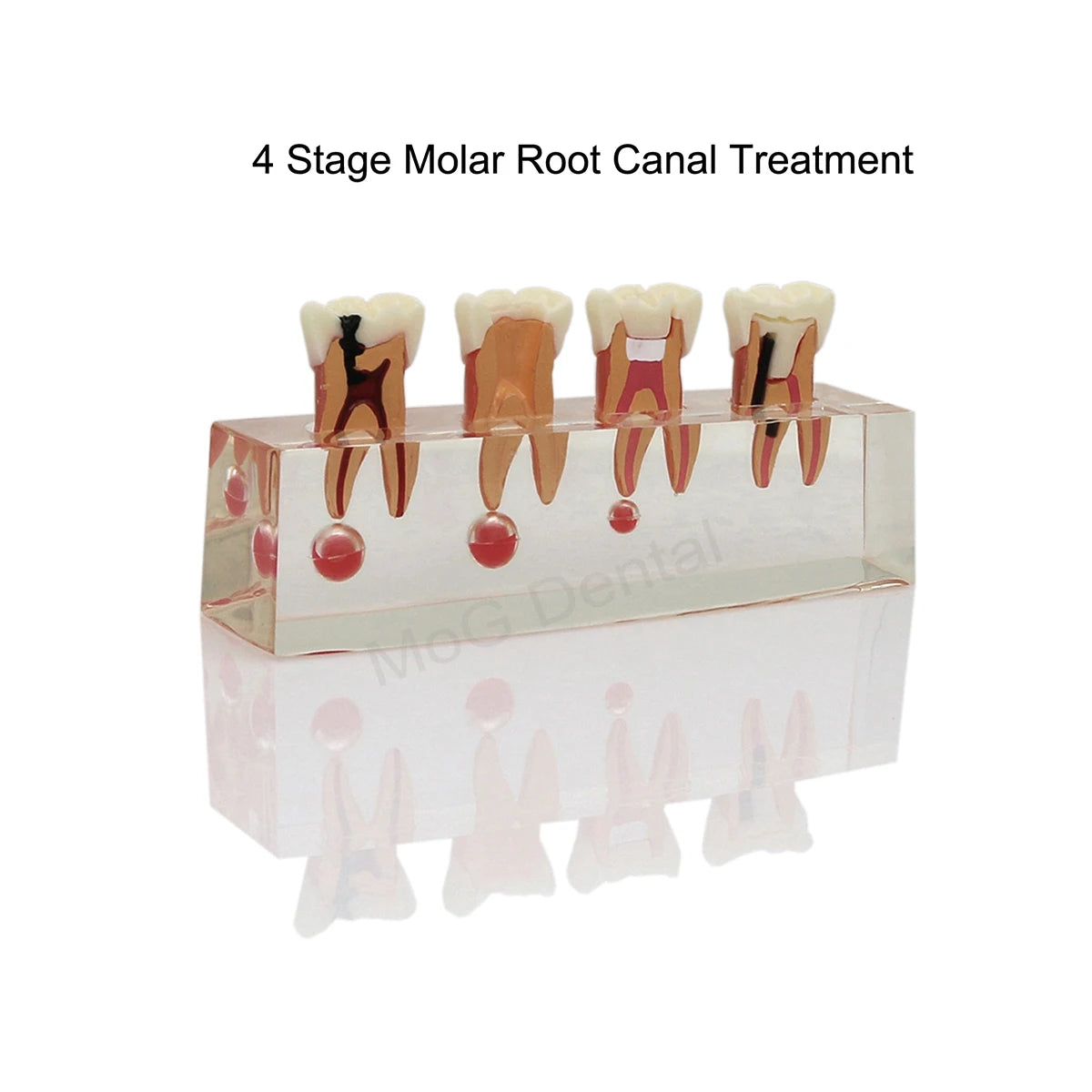 Root Canal Anatomy Teaching Model