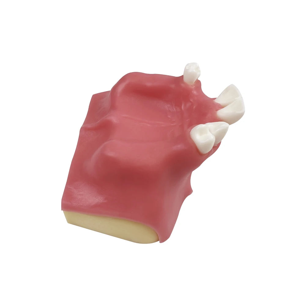 Maxillary Sinus & Implant Teaching Model (Soft Gum)
