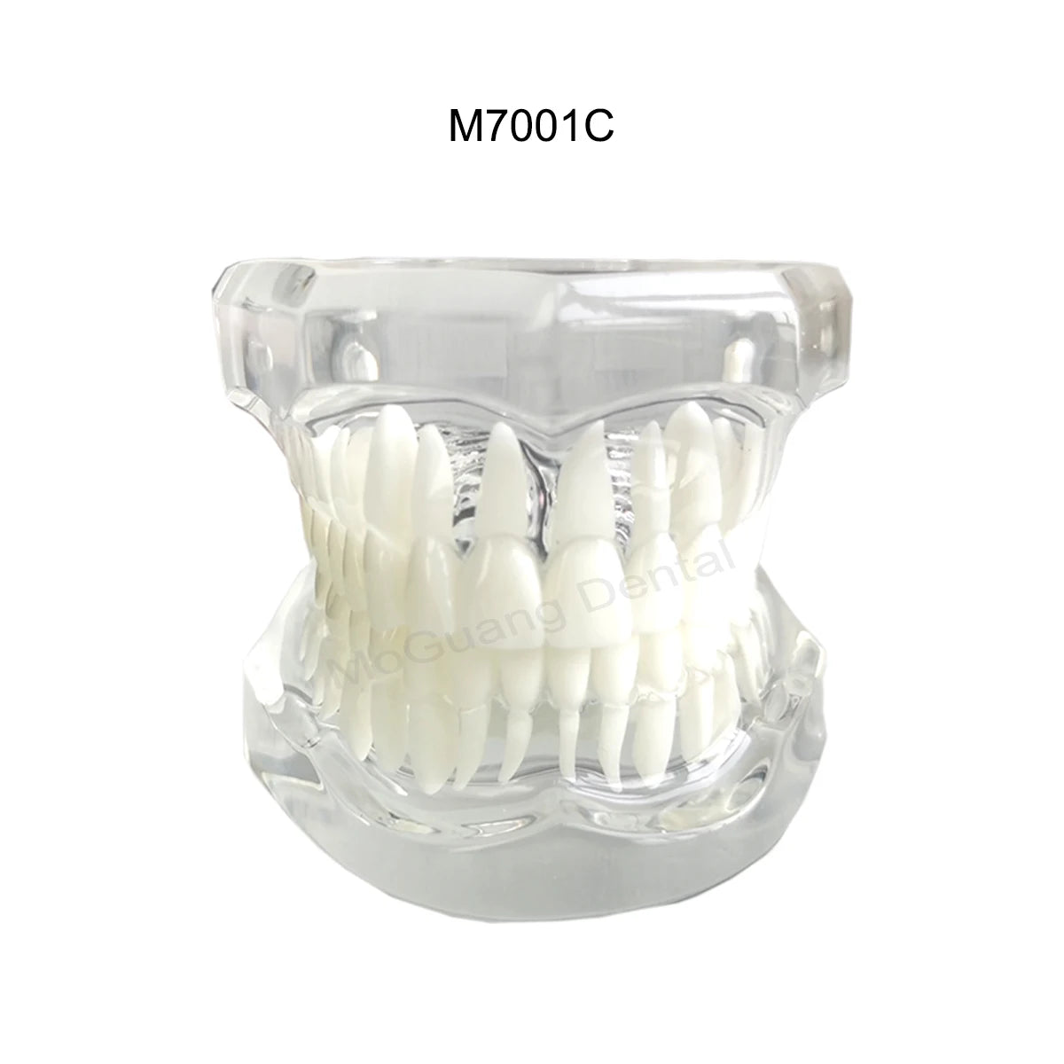 Dental Teeth Model Implant with Removable Dental Education Model for Dentistry Laboratory Demo Studying Dentistry Products Tool