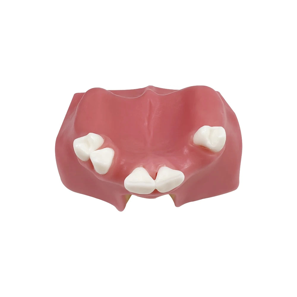 Maxillary Sinus & Implant Teaching Model (Soft Gum)