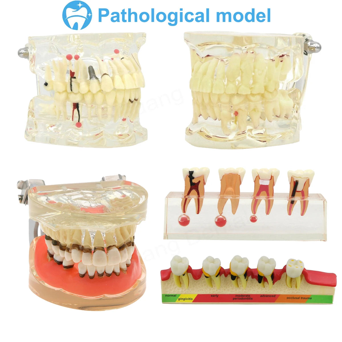 Dental Teeth Model Implant with Removable Dental Education Model for Dentistry Laboratory Demo Studying Dentistry Products Tool