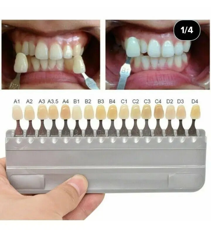 Acrylic Denture Teeth Set (Shades A1–D4, Upper/Lower)