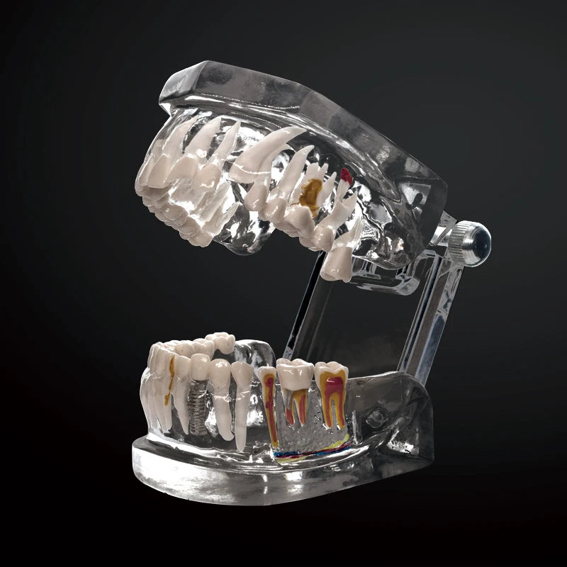 Transparent Oral Pathology Teaching Model