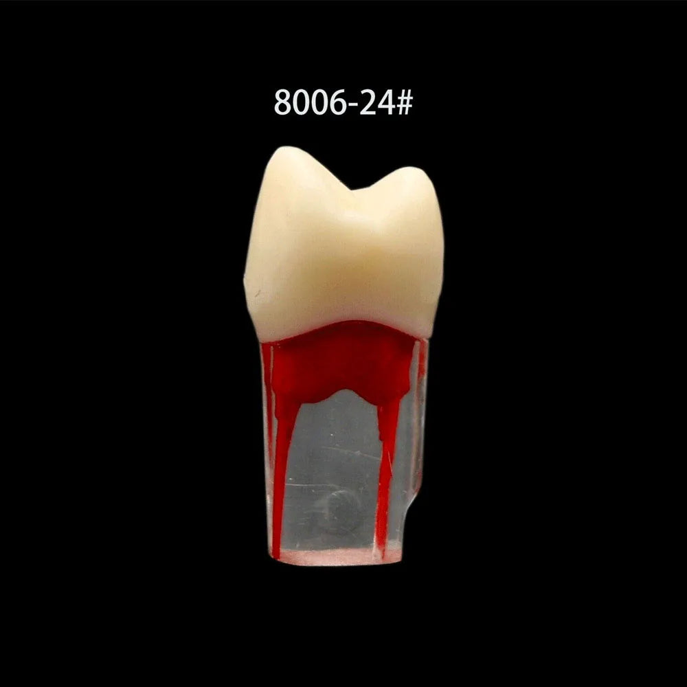 OLEVO 10 Pcs Dental RCT Endo Teeth Model Endodontic Root Canal Block Pulp Cavity Resin Study Practice Endodontic Training M8006