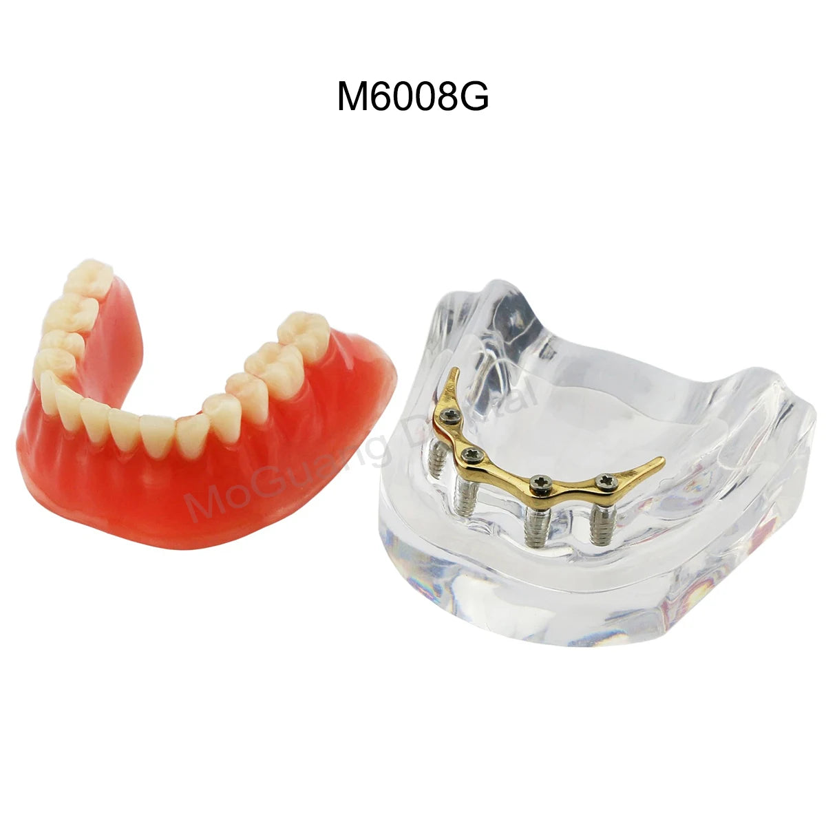 Dental Teeth Model Implant with Removable Dental Education Model for Dentistry Laboratory Demo Studying Dentistry Products Tool