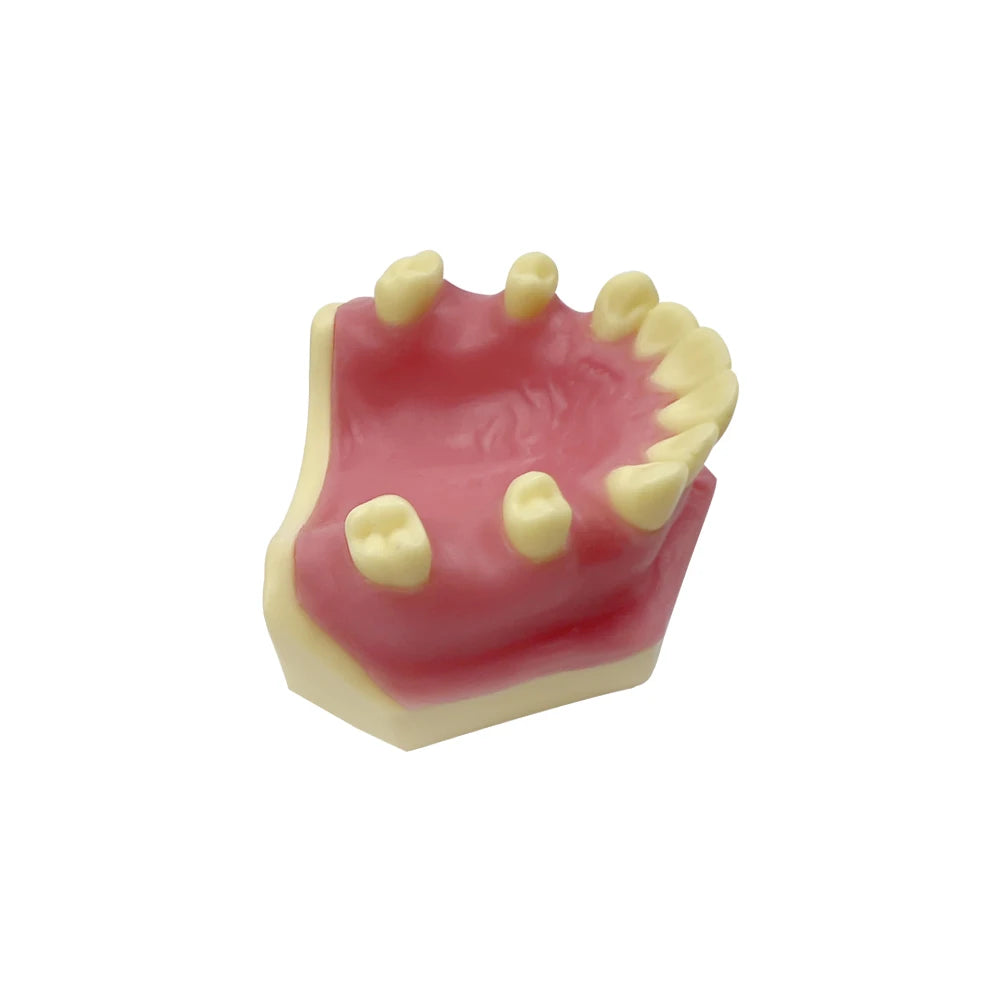 Maxillary Sinus & Implant Teaching Model (Soft Gum)