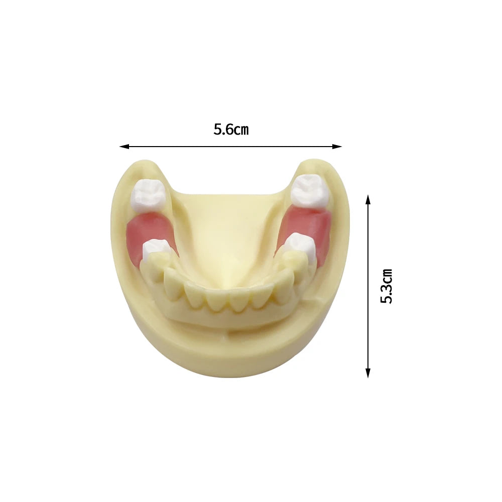 Maxillary Sinus & Implant Teaching Model (Soft Gum)