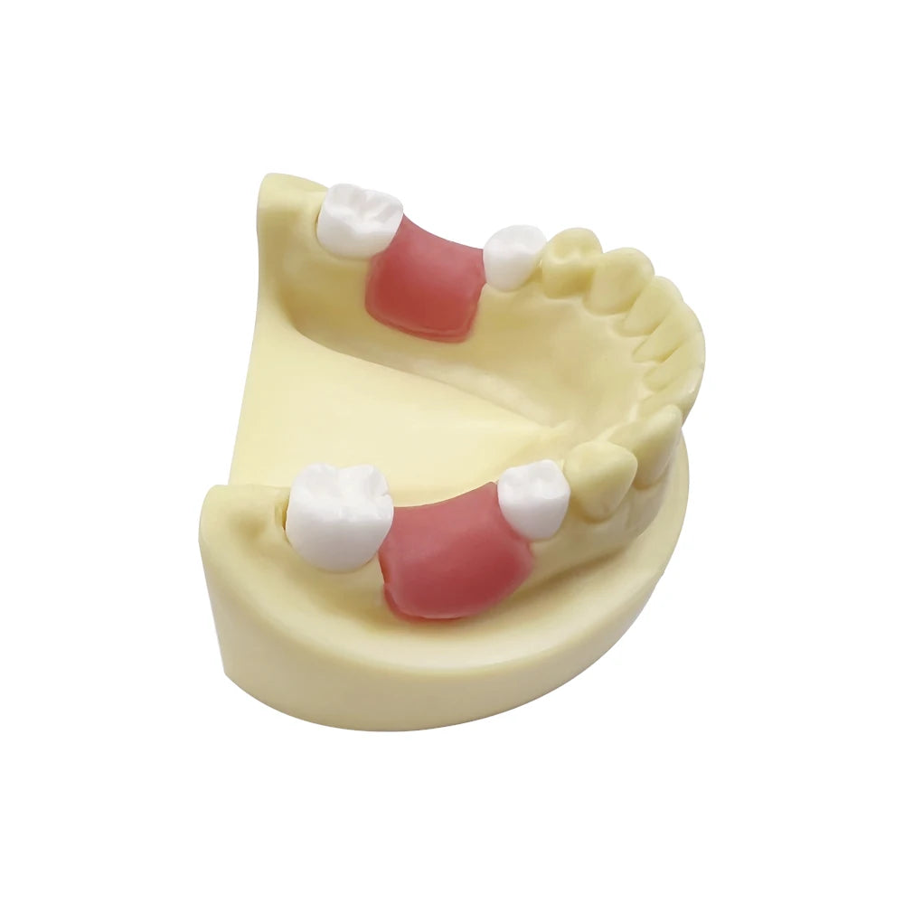 Maxillary Sinus & Implant Teaching Model (Soft Gum)