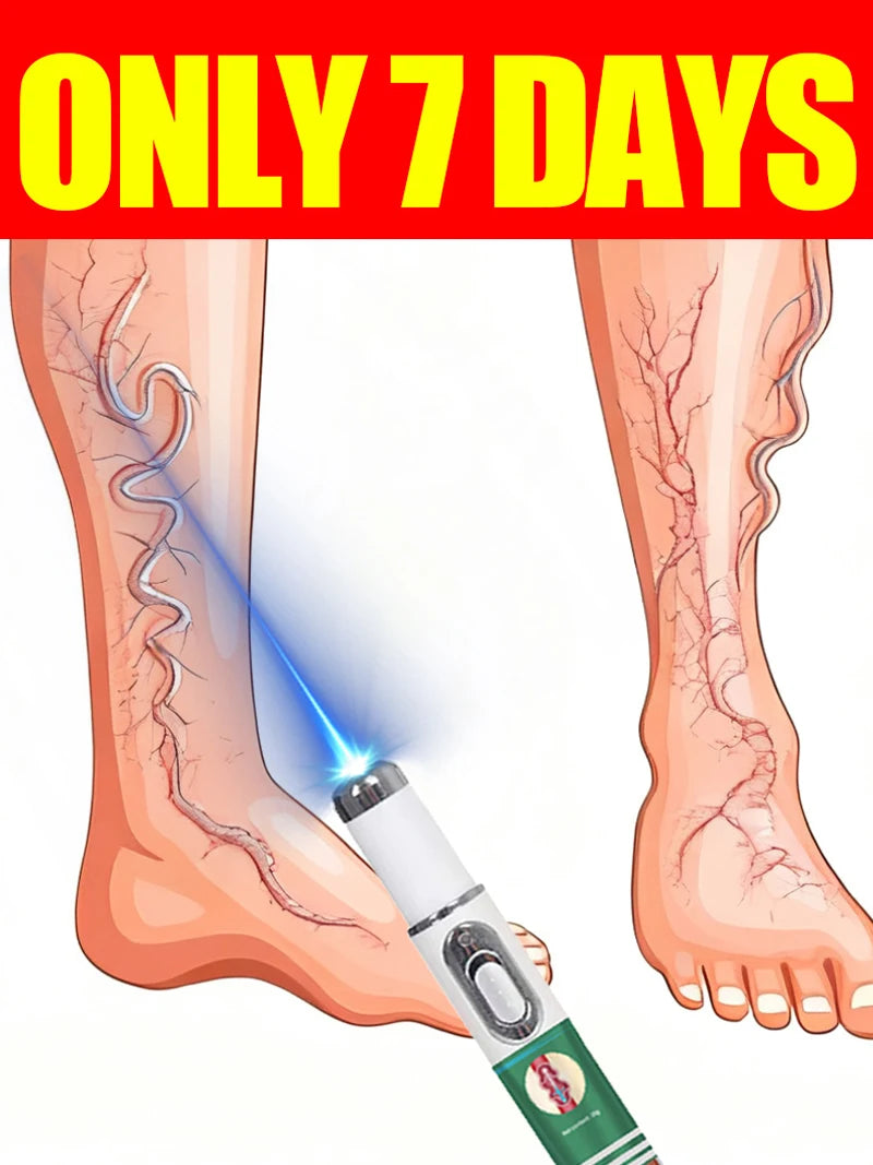 Vein Therapy Device
