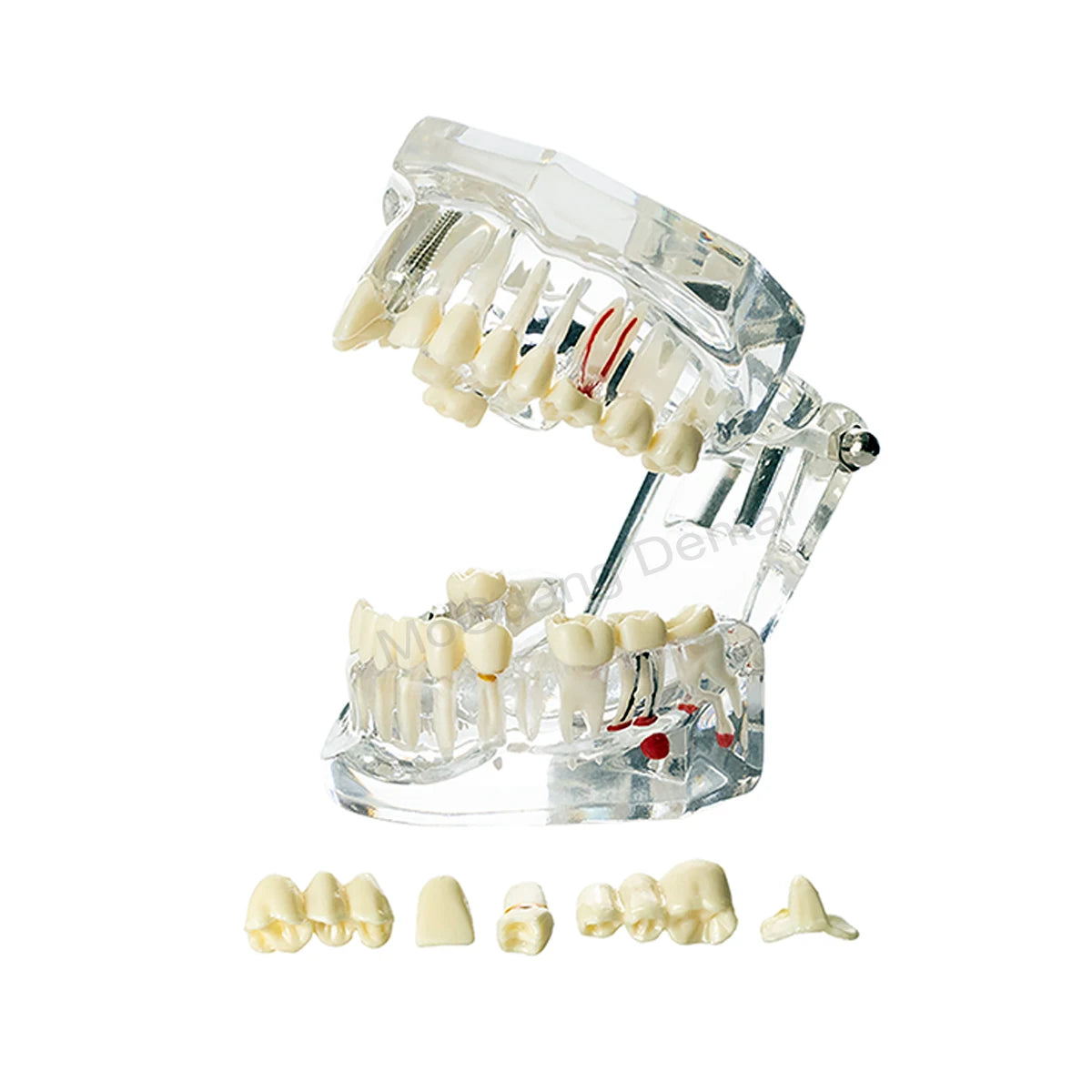 Dental Teeth Model Implant with Removable Dental Education Model for Dentistry Laboratory Demo Studying Dentistry Products Tool