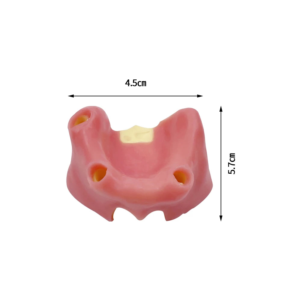 Maxillary Sinus & Implant Teaching Model (Soft Gum)