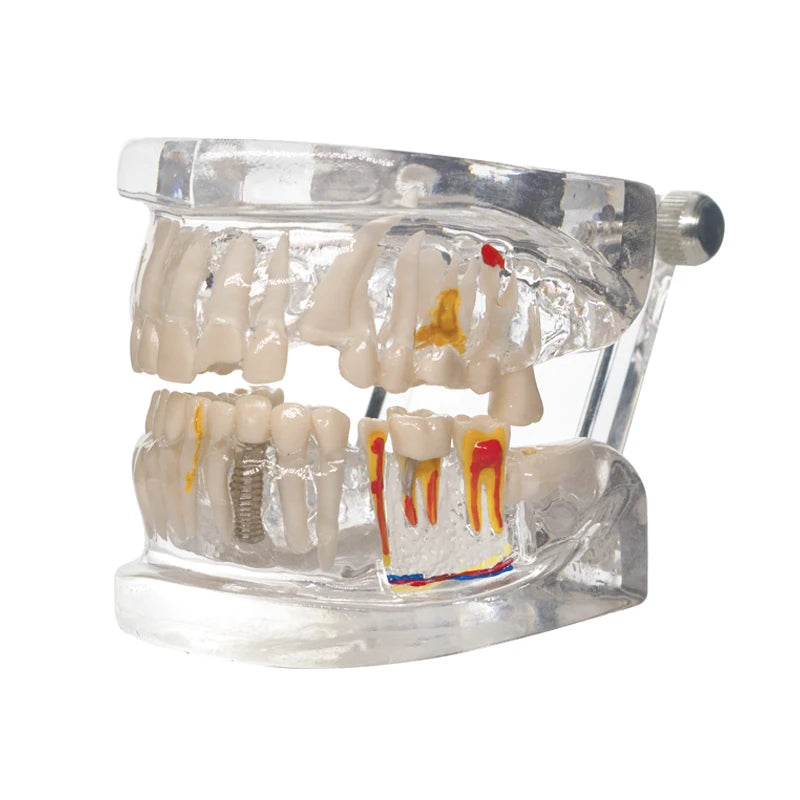 Transparent Oral Pathology Teaching Model