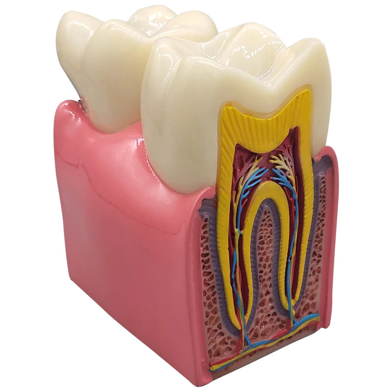 Magnified Caries & Implant Demonstration Model