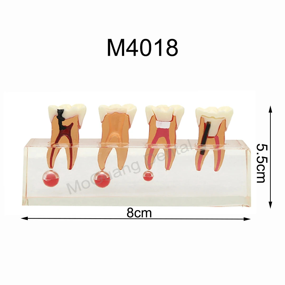 Dental Teeth Model Implant with Removable Dental Education Model for Dentistry Laboratory Demo Studying Dentistry Products Tool