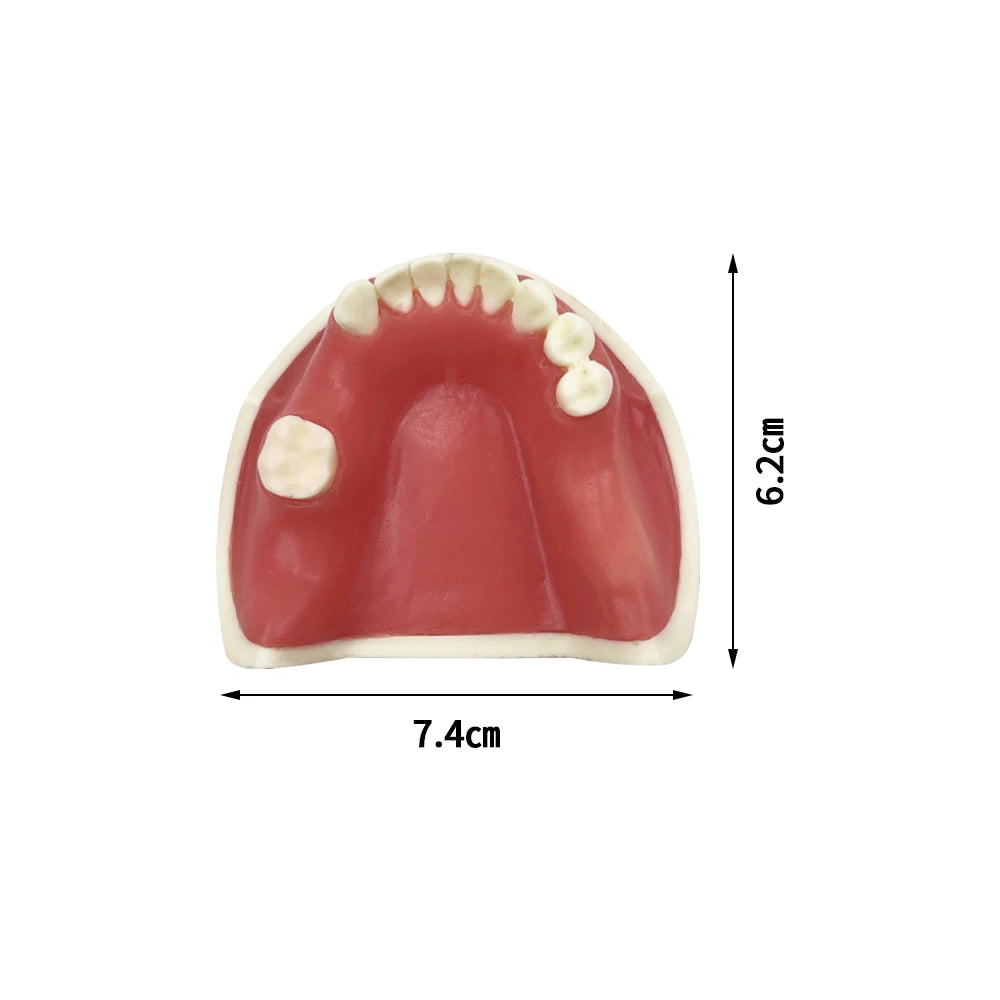 Maxillary Sinus & Implant Teaching Model (Soft Gum)