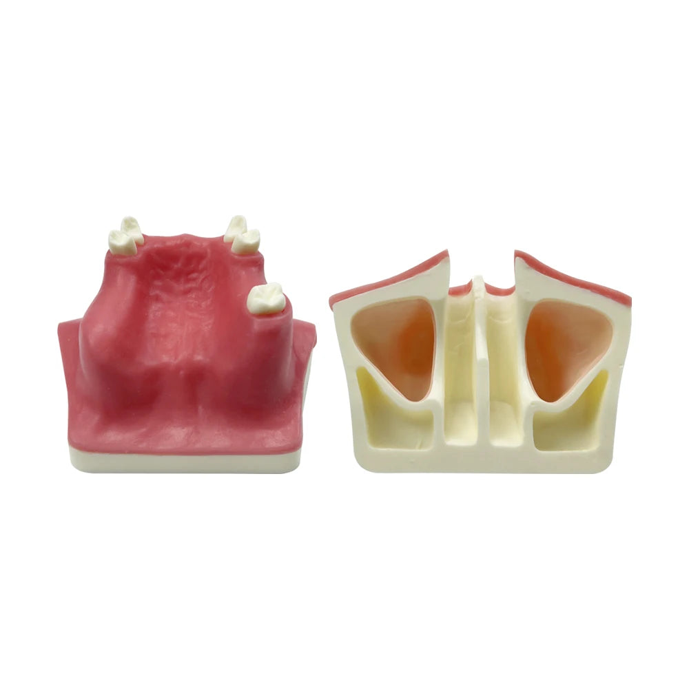 Maxillary Sinus & Implant Teaching Model (Soft Gum)