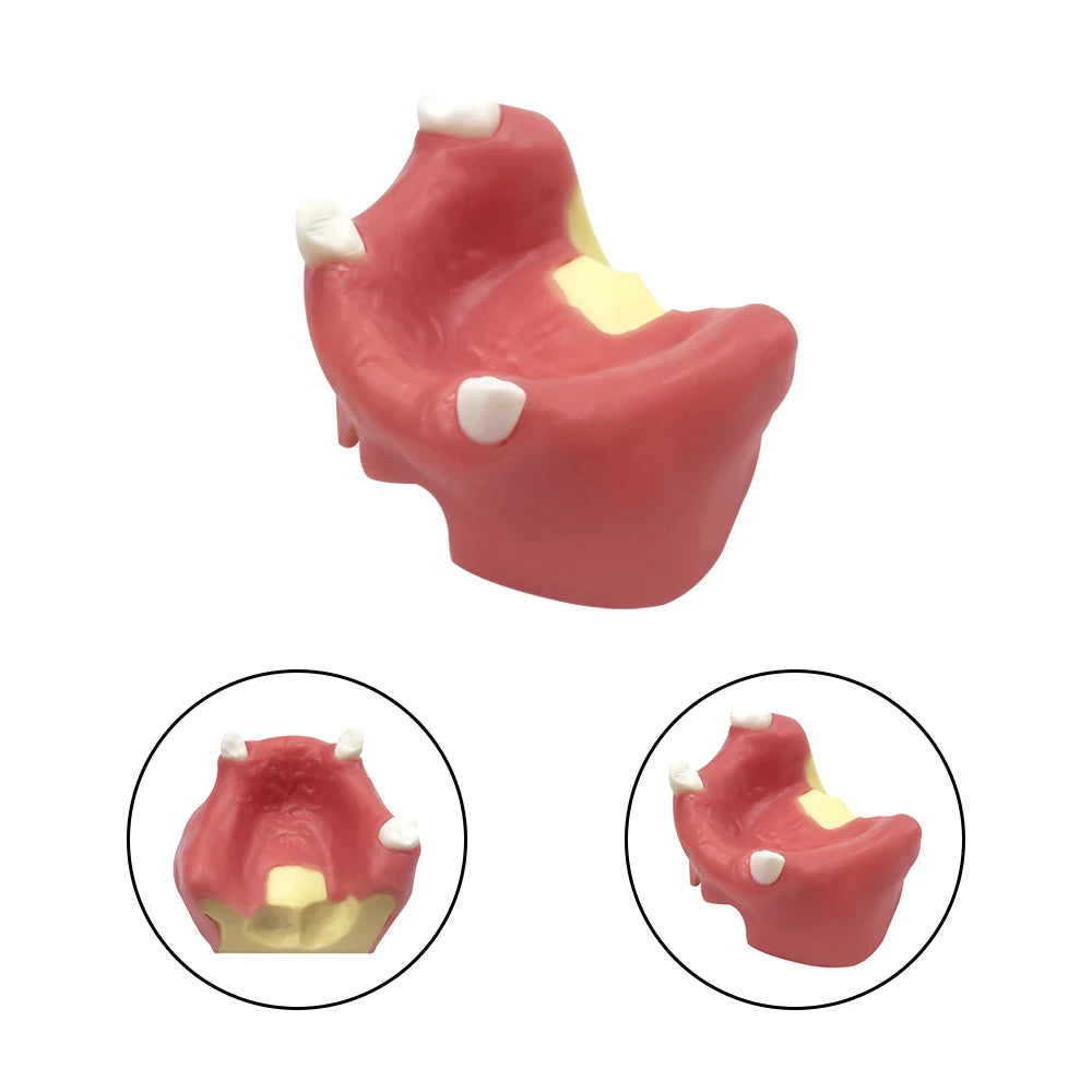 Maxillary Sinus & Implant Teaching Model (Soft Gum)
