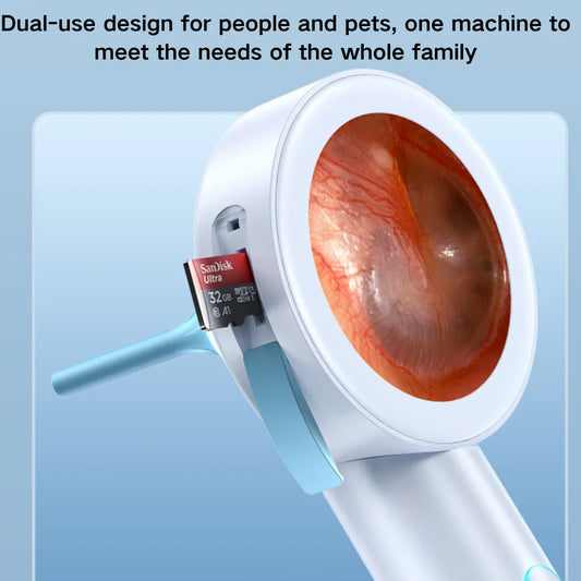 HD Digital Visual Otoscope (Integrated 1.8" Diagnostic Screen)