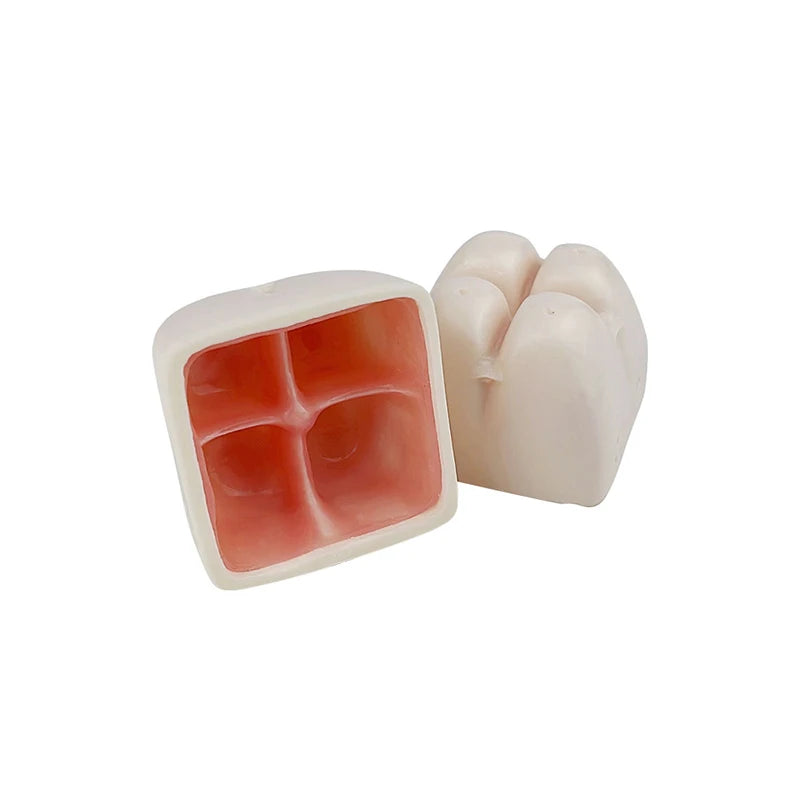 Maxillary Sinus & Implant Teaching Model (Soft Gum)
