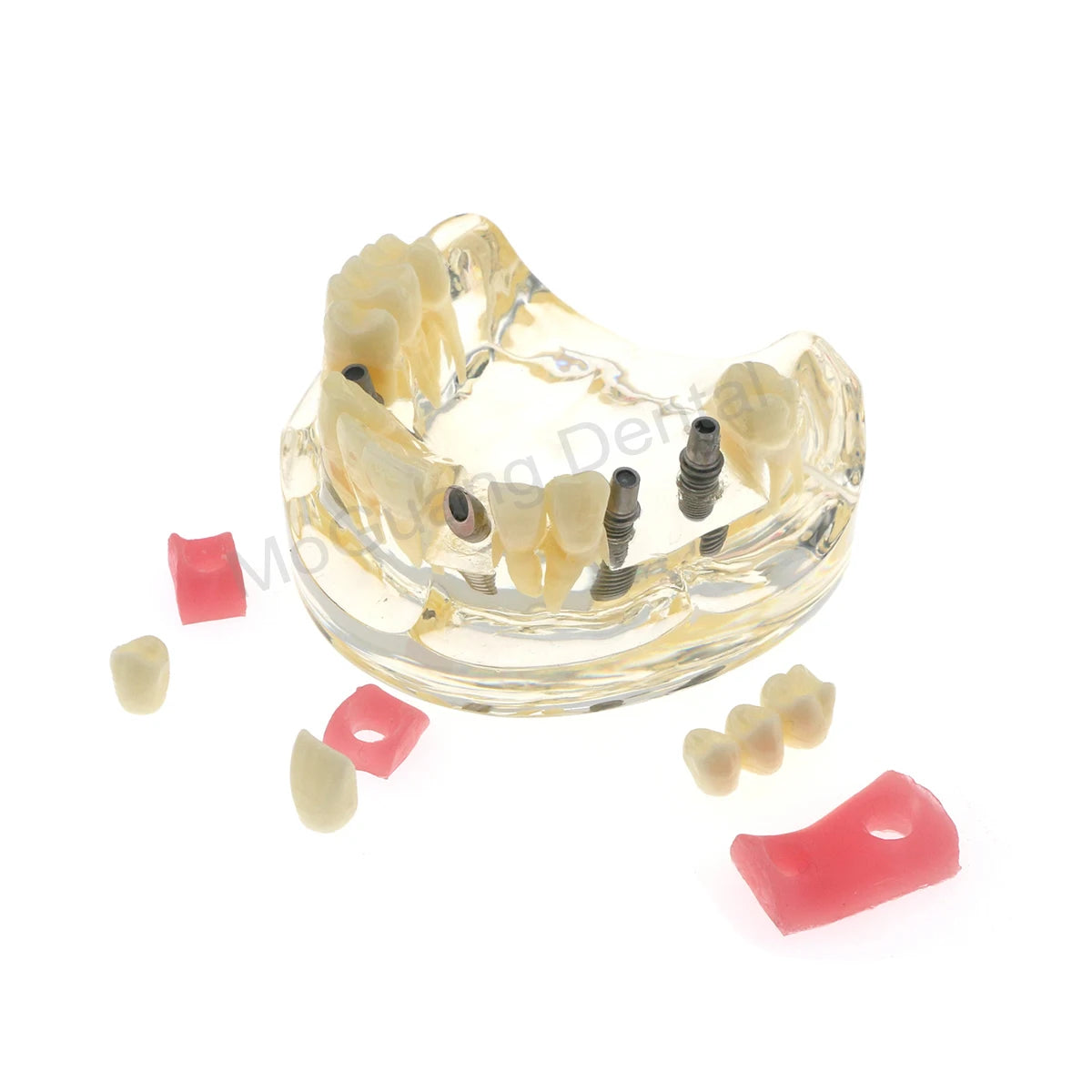 Dental Teeth Model Implant with Removable Dental Education Model for Dentistry Laboratory Demo Studying Dentistry Products Tool