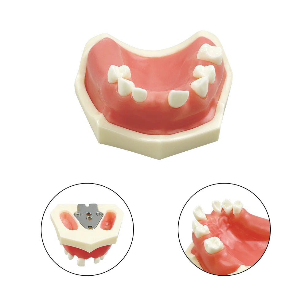 Maxillary Sinus & Implant Teaching Model (Soft Gum)