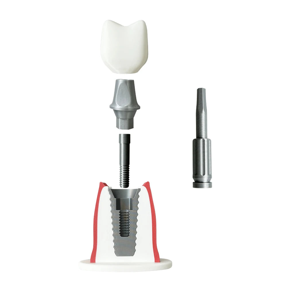 Detachable Implant Demonstration Model (Large)