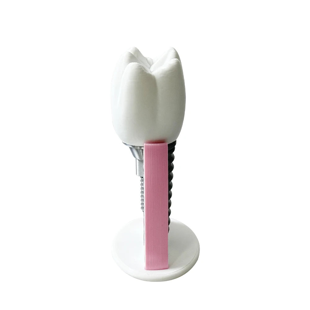 Detachable Implant Demonstration Model (Large)