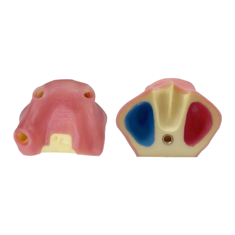 Maxillary Sinus & Implant Teaching Model (Soft Gum)