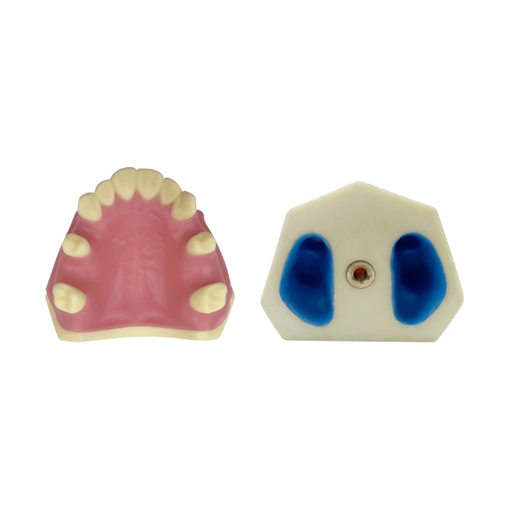 Maxillary Sinus & Implant Teaching Model (Soft Gum)