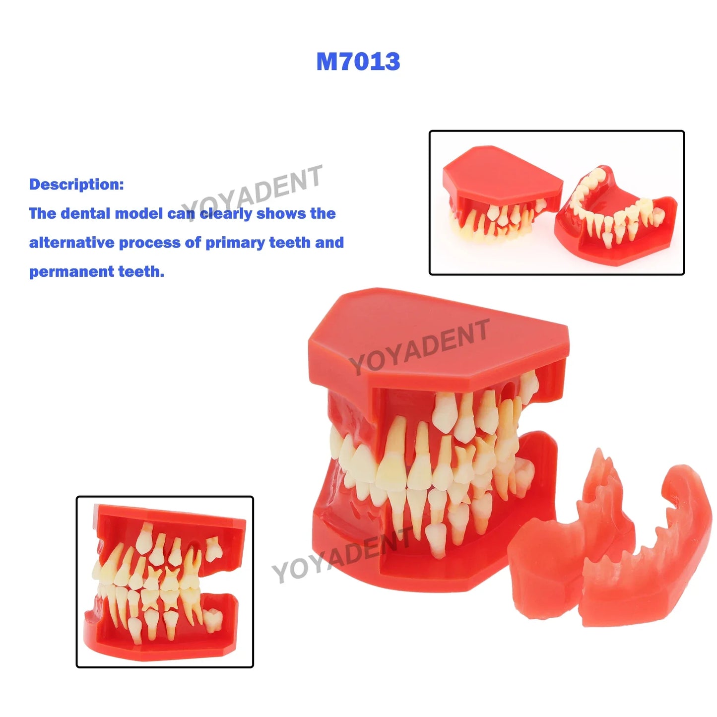 Mixed-Dentition Deciduous-to-Permanent Tooth Replacement Model