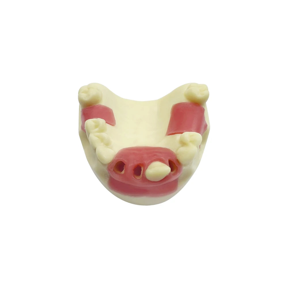 Maxillary Sinus & Implant Teaching Model (Soft Gum)