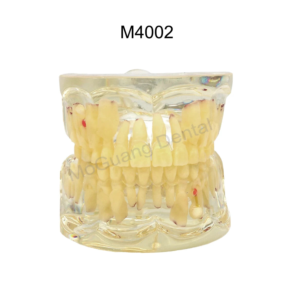 Dental Teeth Model Implant with Removable Dental Education Model for Dentistry Laboratory Demo Studying Dentistry Products Tool
