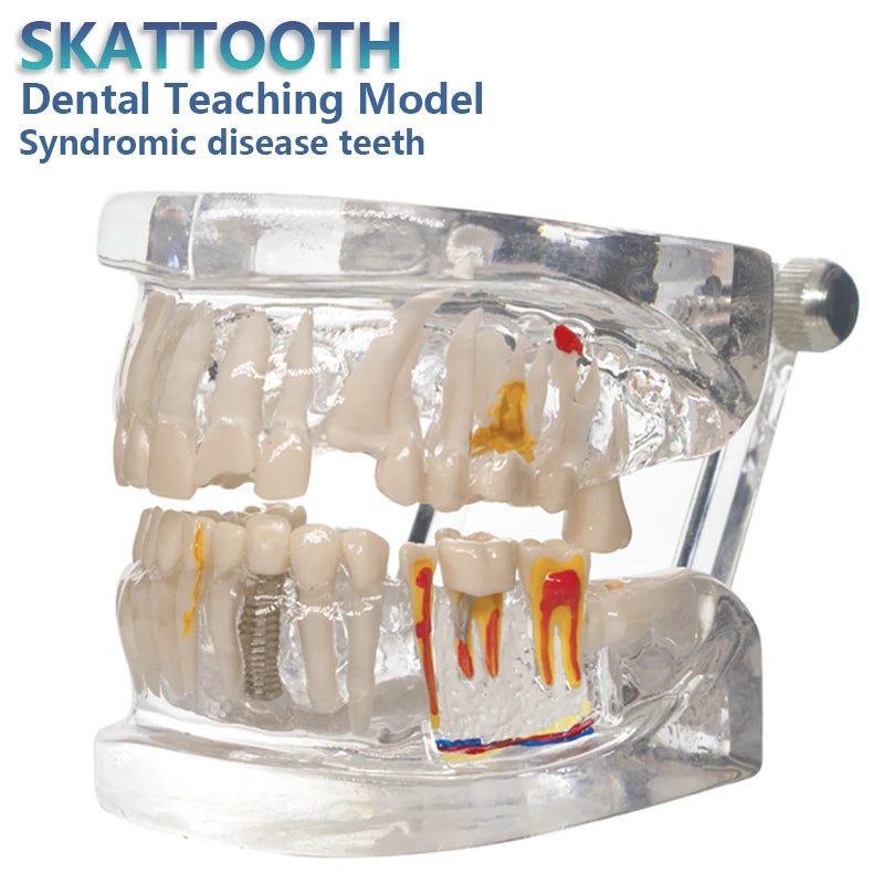Transparent Oral Pathology Teaching Model