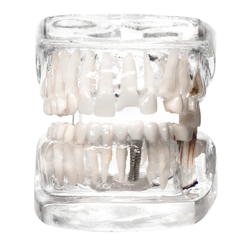 Transparent Oral Pathology Teaching Model