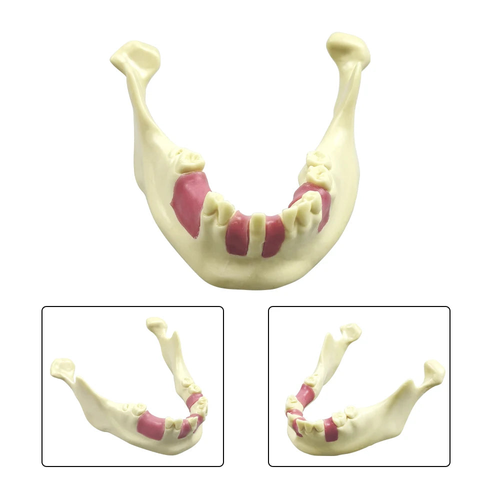 Maxillary Sinus & Implant Teaching Model (Soft Gum)